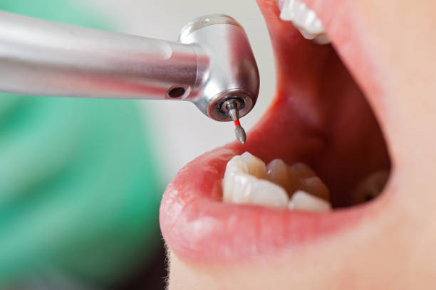 Best Emergency Dental Care for Sports Injuries in Sellersville, PA